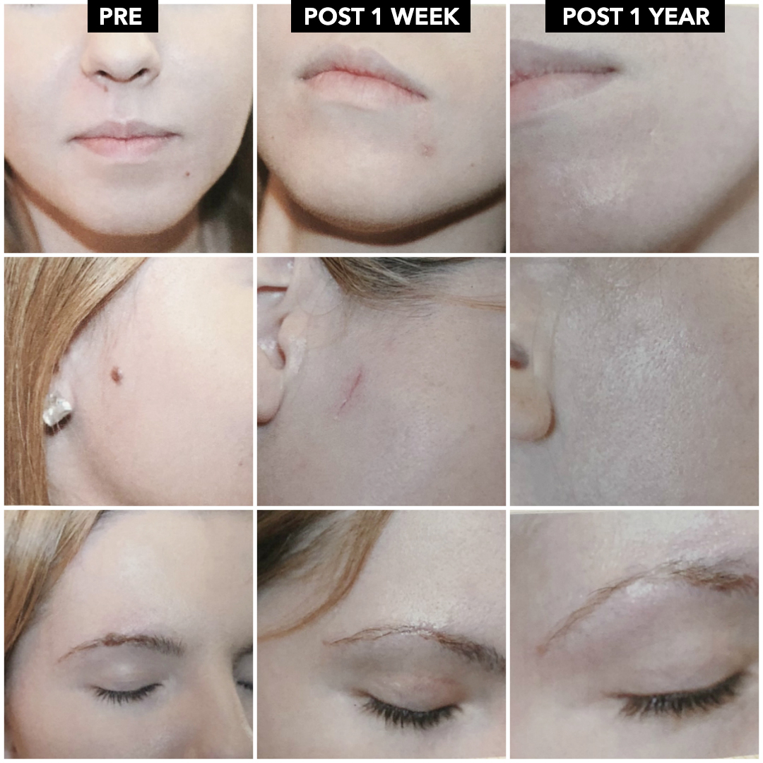 Skin care consultation